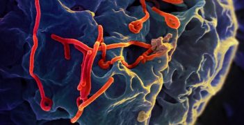 Ebola virus. Image credit: Flickr (NIAID)