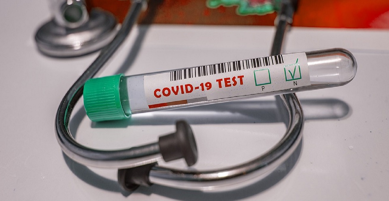 COVID-19 test. Source: Fernando Zhiminaicela https://bit.ly/3n5QL2U 