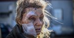 A wounded woman stands outside a hospital after the bombing of the eastern Ukraine town of Chuguiv on February 24, 2022.
Source: Photo by ARIS MESSINIS/AFP via Getty Images, https://bit.ly/36Yz2VG